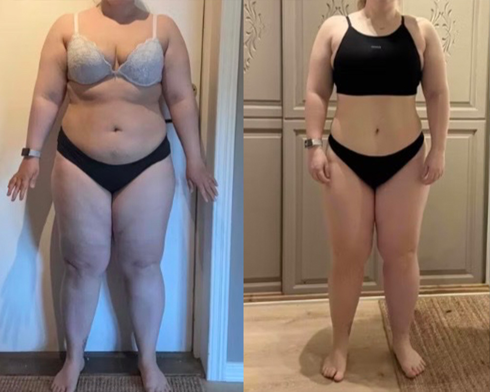 Transformation 3